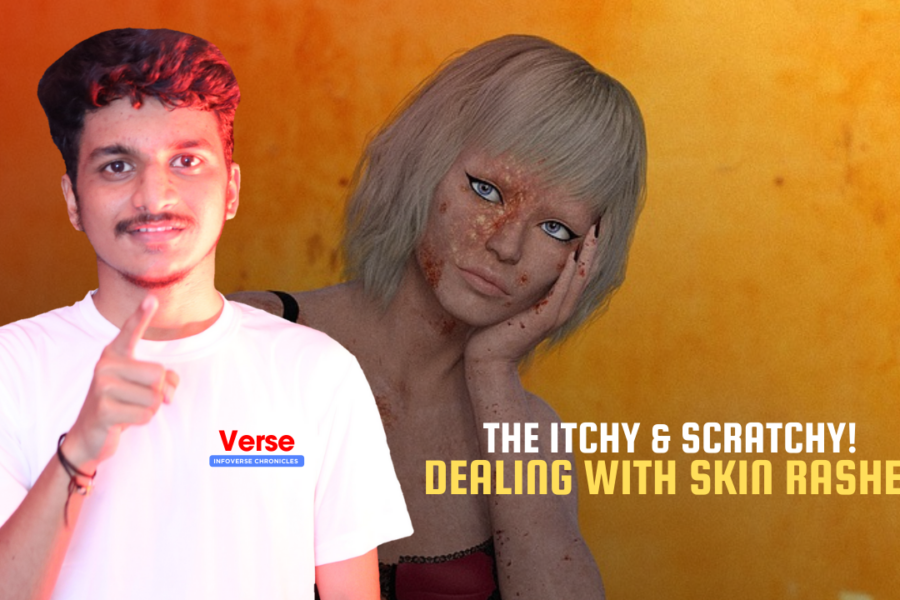 The Itchy & Scratchy! Dealing with Skin Rashes