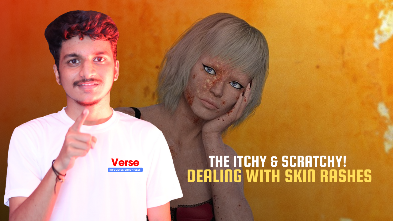 The Itchy & Scratchy! Dealing with Skin Rashes